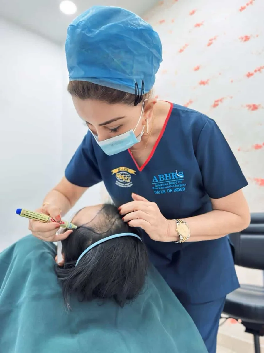 Dr. Inder marking a patient's hairline before a hair restoration procedure.
